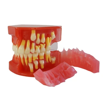 שיניים הדגם עם 28 להסרה שיניים רפואי כלי הלימוד שיניים שיקום הפגנה מודל למחקר.